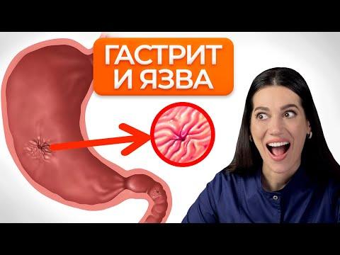 Гастрит и Язва желудка. Питание при ГАСТРИТЕ. Стол №1 по Певзнеру.